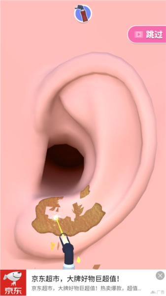 你是来掏耳屎的吧新手攻略图片5