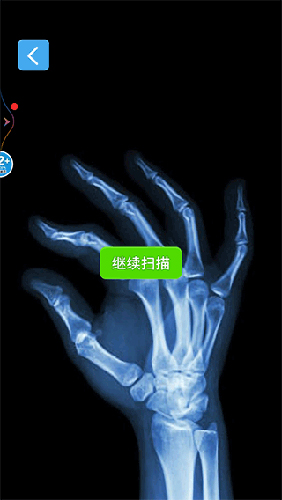 x射线模拟器(辐射检测仪)图片6